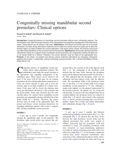 Congenitally missing mandibular second premolars: Clinical options