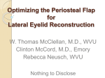 Optimizing the Periosteal Flap for Lateral Eyelid Reconstruction