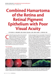 Combined Hamartoma of the Retina and Retinal Pigment Epithelium