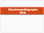 Electrocardiographs ECG