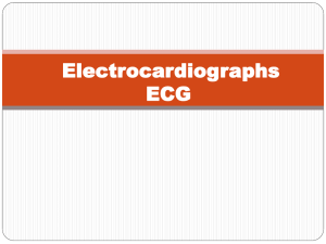 Electrocardiographs ECG