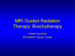 Image Guided Radiation Therapy: Brachytherapy - NA