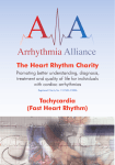 Tachycardia (Fast Heart Rhythm)
