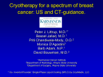 Cryotherapy for Malignant Breast Masses