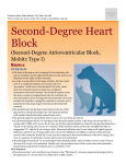 Second-Degree Heart Block (Second-Degree Atrioventricular Block