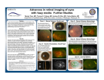 Advances in retinal imaging of eyes with hazy media: Further
