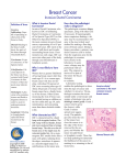 Breast Cancer - Invasive Ductal Carcinoma