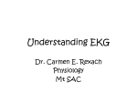 Understanding EKG