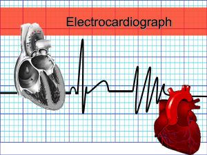 ECG - WordPress.com