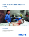 Non-Invasive Transcutaneous Pacing