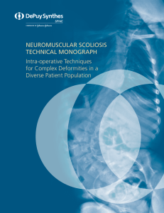 NEUROMUSCULAR SCOLIOSIS TECHNICAL