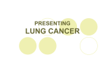 presenting lung cancer
