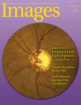 Images Magazine 2015 Issue 2 - Bascom Palmer Eye Institute