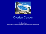ovarian cancer (19th May)