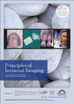 Principles of Intraoral Imaging