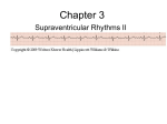 ECG Lecture Chapter 3
