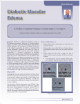 Diabetic Macular Edema