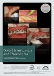 Soft-Tissue Lasers and Procedures