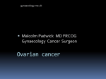 Ovarian cancer - Malcolm Padwick MD, FRCOG