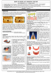 how to replace missing teeth?