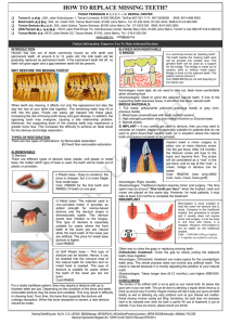 how to replace missing teeth?