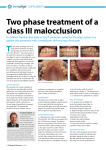 Two phase treatment of a class III malocclusion