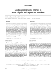 Electrocardiographic changes in acute tricyclic