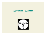 Ovarian Cancer