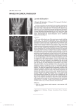 Lunate dislocation IMAGES IN CLINICAL RADIOLOGY A B
