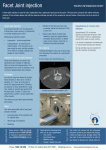 Facet Joint injection - Canberra Imaging Group