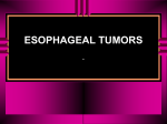 Esophageal Tumors