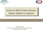 Ischemic Mitral Valve Disease: Repair, Replace or Ignore?