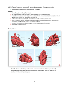 CASE 4. Twisted heart with congenitally corrected transposition of