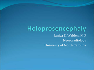 Holoprosencephaly