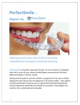 PerfectSmile info and general procedure