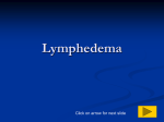 Lymphedema - Laura Kupperman