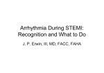 Arrhythmia During STEMI: Recognition and What to Do