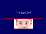 The Red Eye - helpfuldoctors