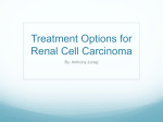 Treatment Options for Renal Cell Carcinoma
