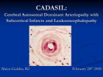 AHD Geddes CADASIL Feb 27