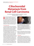 Ciliochoroidal Metastasis from Renal Cell Carcinoma