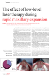 The effect of low-level laser therapy during rapid maxillary expansion