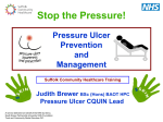 What is a pressure ulcer?
