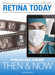 vitreoretinal surgery