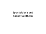 Spondylolysis-and-Spondylolisthesis-Handout