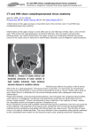 CT and MRI show complexparanasal sinus anatomy