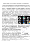 Quantitative Transcatheter Intraarterial Perfusion MRI to