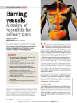 Burning vessels - Pain Management Today