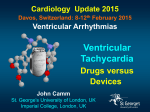 Ventricular Tachycardia - European Society of Cardiology