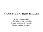 Hypoplastic Left Heart Syndrome - SUNY Upstate Medical University